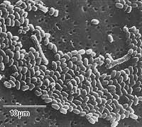 Electron Micrograph Anthrax Spores