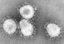 SARS Virus, WikiMedia Commons